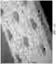 Fig. 19 - WOUND DRESSING AND METHOD OF USE
