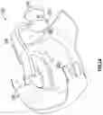 Fig. 03 - Wearable device