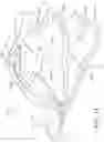 Fig. 16 - Patient turning device for a patient support apparatus