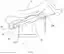 Fig. 07 - Patient securement system for the surgical Trendelenburg position