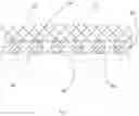 Fig. 12 - Patient securement system for the surgical Trendelenburg position