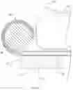 Fig. 33 - Patient securement system for the surgical Trendelenburg position
