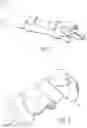 Fig. 02 - Patient-Responsive Orthosis