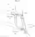 Fig. 06 - WALKING ASSISTANCE APPARATUS
