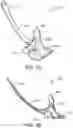 Fig. 03 - PRESSURE RELEASE AND MASSAGE TOOL