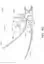 Fig. 12 - Pressure release and massage tool