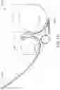 Fig. 16 - Pressure release and massage tool