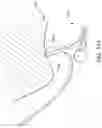 Fig. 17 - Pressure release and massage tool