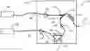Fig. 01 - APPARATUS FOR DELIVERY OF RADIOEMBOLIZATION MICROSPHERES