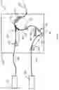 Fig. 02 - APPARATUS FOR DELIVERY OF RADIOEMBOLIZATION MICROSPHERES