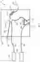 Fig. 03 - APPARATUS FOR DELIVERY OF RADIOEMBOLIZATION MICROSPHERES