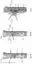 Fig. 11 - APPARATUS FOR DELIVERY OF RADIOEMBOLIZATION MICROSPHERES