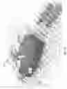 Fig. 21 - APPARATUS FOR DELIVERY OF RADIOEMBOLIZATION MICROSPHERES