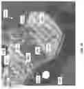 Fig. 22 - APPARATUS FOR DELIVERY OF RADIOEMBOLIZATION MICROSPHERES