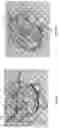 Fig. 24 - APPARATUS FOR DELIVERY OF RADIOEMBOLIZATION MICROSPHERES