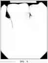 Fig. 13 - DENTAL COMPOSITION AND PREPARATION METHOD THEREFOR