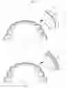 Fig. 02 - Preparation for Attaching to Teeth or Surrounding Part of Teeth
