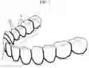 Fig. 04 - Preparation for Attaching to Teeth or Surrounding Part of Teeth