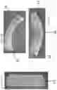 Fig. 05 - Oral care article comprising a delivery carrier and solid hydrophilic particles comprising a bleaching agent