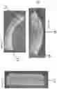 Fig. 05 - Oral care article comprising a delivery carrier and solid hydrophilic particles comprising an active agent