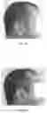 Fig. 05 - Use Of A Composition For The Pigmentation Of Hair And Hairs