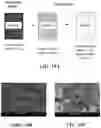 Fig. 15 - Implantable depots for the controlled release of therapeutic agents