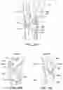 Fig. 31 - Implantable depots for the controlled release of therapeutic agents
