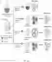 Fig. 02 - PREPARING LIPOSOMES WITH HIGH DRUG LOADING CAPACITY AND THE USE THEREOF