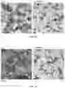 Fig. 04 - PREPARING LIPOSOMES WITH HIGH DRUG LOADING CAPACITY AND THE USE THEREOF