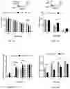 Fig. 07 - PREPARING LIPOSOMES WITH HIGH DRUG LOADING CAPACITY AND THE USE THEREOF