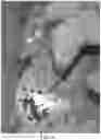 Fig. 04 - Alginate Beads and Methods of Manufacture and Use Thereof