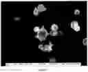 Fig. 05 - Spray-Dried Blood Products and Methods of Making Same