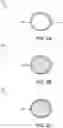 Fig. 03 - SUBLINGUAL DELIVERY FOR MITIGATION OF SIDE EFFECTS ASSOCIATED WITH VORTIOXETINE