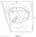 Fig. 05 - Transdermal patch providing improved permeability and composition