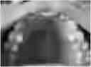 Fig. 01 - ADHESIVE PAD