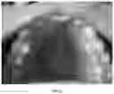 Fig. 06 - ADHESIVE PAD