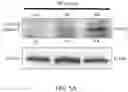 Fig. 13 - METHOD FOR PREVENTING OR TREATING HIGH-GRADE SEROUS CARCINOMA