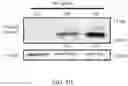 Fig. 16 - METHOD FOR PREVENTING OR TREATING HIGH-GRADE SEROUS CARCINOMA
