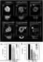 Fig. 01 - Use of small molecule inhibitors of the BfrB:Bfd interaction in biofilms