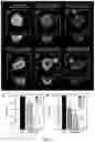 Fig. 03 - Use of small molecule inhibitors of the BfrB:Bfd interaction in biofilms
