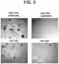 Fig. 06 - METHOD OF TREATING FIBROSIS