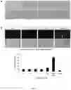 Fig. 11 - Compositions and Methods for the Treatment of Prader-Willi Syndrome
