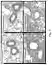 Fig. 12 - Methods and compositions relating to the treatment of fibrosis