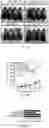 Fig. 04 - COMPOSITIONS AND METHODS FOR INDUCING OR SUPPLEMENTING SOCS3 TO ABROGATE TUMOR GROWTH AND PROLIFERATIVE RETINOPATHY