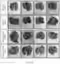 Fig. 05 - COMPOSITIONS AND METHODS FOR INDUCING OR SUPPLEMENTING SOCS3 TO ABROGATE TUMOR GROWTH AND PROLIFERATIVE RETINOPATHY