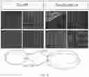 Fig. 11 - COMPOSITIONS AND METHODS FOR INDUCING OR SUPPLEMENTING SOCS3 TO ABROGATE TUMOR GROWTH AND PROLIFERATIVE RETINOPATHY