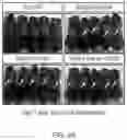 Fig. 12 - COMPOSITIONS AND METHODS FOR INDUCING OR SUPPLEMENTING SOCS3 TO ABROGATE TUMOR GROWTH AND PROLIFERATIVE RETINOPATHY