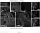 Fig. 17 - COMPOSITIONS AND METHODS FOR INDUCING OR SUPPLEMENTING SOCS3 TO ABROGATE TUMOR GROWTH AND PROLIFERATIVE RETINOPATHY