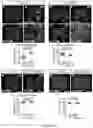 Fig. 34 - COMPOSITIONS AND METHODS FOR INDUCING OR SUPPLEMENTING SOCS3 TO ABROGATE TUMOR GROWTH AND PROLIFERATIVE RETINOPATHY