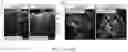 Fig. 36 - COMPOSITIONS AND METHODS FOR INDUCING OR SUPPLEMENTING SOCS3 TO ABROGATE TUMOR GROWTH AND PROLIFERATIVE RETINOPATHY